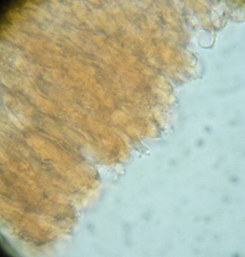 Stereum sanguinolentum?